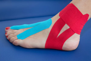 taping-neuromuscolare tape therapy